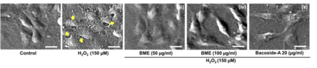 SEM images (Scale bar: 20 μm) showing the morphology of HT-22 cells pre-treated with BME and Bacoside-A in presence of oxidative stress.